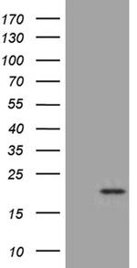 SEC11A Antibody in Western Blot (WB)