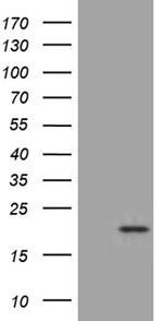 SEC11A Antibody in Western Blot (WB)