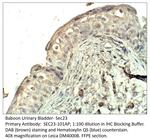 SEC23 Polyclonal Antibody
