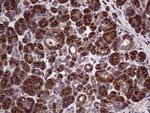 SEC23B Antibody in Immunohistochemistry (Paraffin) (IHC (P))