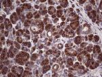 SEC23B Antibody in Immunohistochemistry (Paraffin) (IHC (P))