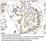 SEC24A Polyclonal Antibody