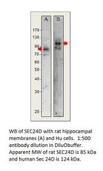 SEC24D Polyclonal Antibody