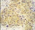 SEMA3A Antibody in Immunohistochemistry (IHC)