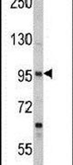 SEMA3A Antibody in Western Blot (WB)