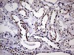 SEMA4D Antibody in Immunohistochemistry (Paraffin) (IHC (P))