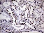 SEMA4D Antibody in Immunohistochemistry (Paraffin) (IHC (P))