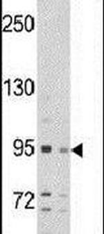 SEMA6A Antibody in Western Blot (WB)