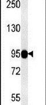 SEMA6A Antibody in Western Blot (WB)