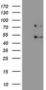 SENP1 Antibody in Western Blot (WB)