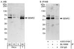 SENP2 Antibody in Western Blot (WB)