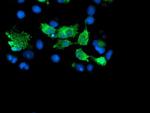 SENP2 Antibody in Immunocytochemistry (ICC/IF)