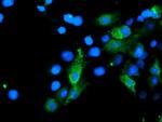 SENP2 Antibody in Immunocytochemistry (ICC/IF)