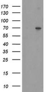 SENP2 Antibody in Western Blot (WB)