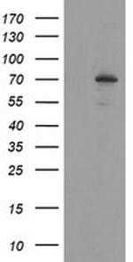SENP2 Antibody in Western Blot (WB)