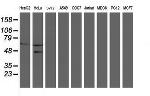SENP2 Antibody in Western Blot (WB)