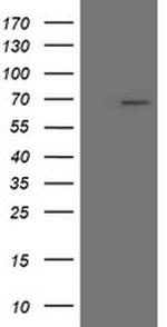 SENP2 Antibody in Western Blot (WB)