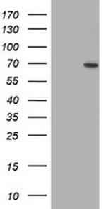 SENP2 Antibody in Western Blot (WB)