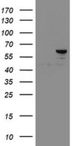 SENP2 Antibody in Western Blot (WB)