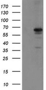 SENP2 Antibody in Western Blot (WB)