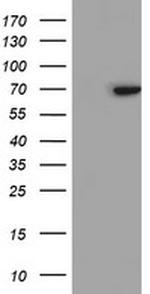 SENP2 Antibody in Western Blot (WB)
