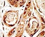 SENP3 Antibody in Immunohistochemistry (IHC)