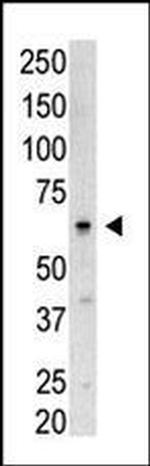 SENP3 Antibody in Western Blot (WB)