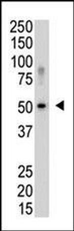 SENP5 Antibody in Western Blot (WB)