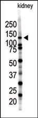 SENP7 Antibody in Western Blot (WB)