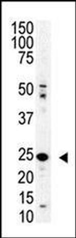 SENP8 Antibody in Western Blot (WB)