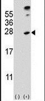 SENP8 Antibody in Western Blot (WB)