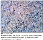 SEPT5 Polyclonal Antibody