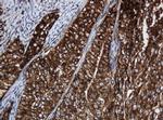 SERBP1 Antibody in Immunohistochemistry (Paraffin) (IHC (P))