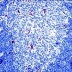 alpha-1 Antitrypsin Antibody in Immunohistochemistry (IHC)