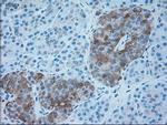 SERPINA1 Antibody in Immunohistochemistry (Paraffin) (IHC (P))