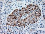 SERPINA1 Antibody in Immunohistochemistry (Paraffin) (IHC (P))