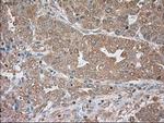 SERPINA1 Antibody in Immunohistochemistry (Paraffin) (IHC (P))