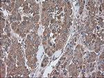 SERPINA1 Antibody in Immunohistochemistry (Paraffin) (IHC (P))