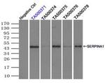 SERPINA1 Antibody in Immunoprecipitation (IP)