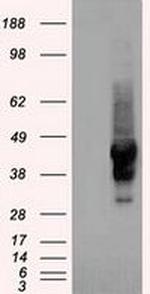 SERPINA1 Antibody in Western Blot (WB)