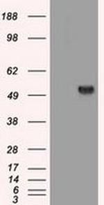 SERPINA1 Antibody in Western Blot (WB)