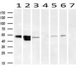 SERPINA1 Antibody in Western Blot (WB)