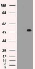 SERPINA1 Antibody in Western Blot (WB)