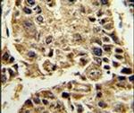 SERPINA4 Antibody in Immunohistochemistry (IHC)