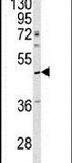 SERPINA4 Antibody in Western Blot (WB)