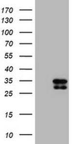 SERPINA5 Antibody in Western Blot (WB)