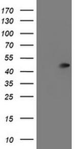 SERPINA5 Antibody in Western Blot (WB)
