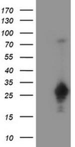 SERPINA5 Antibody in Western Blot (WB)
