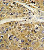 SERPINA7 Antibody in Immunohistochemistry (IHC)