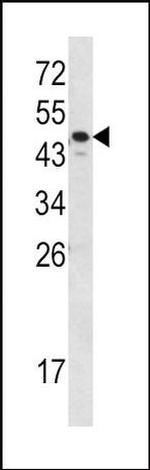 SERPINA7 Antibody in Western Blot (WB)